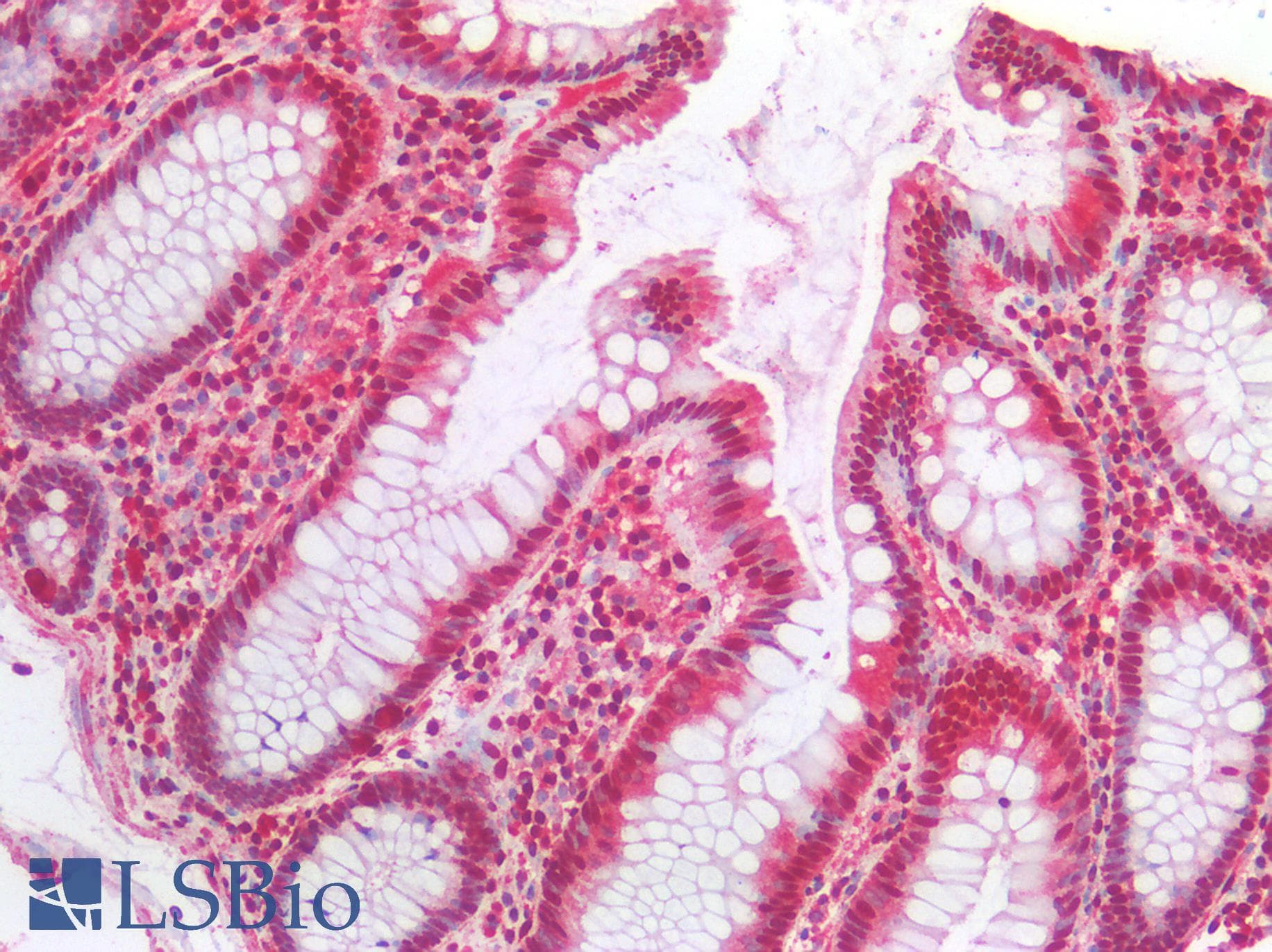 IHC-plus™ Monoclonal Mouse anti-Human SGTA / SGT Antibody (clone AT19E8, IHC, IF, WB)