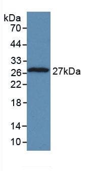 TPT1 / TCTP Antibody (aa1-172)