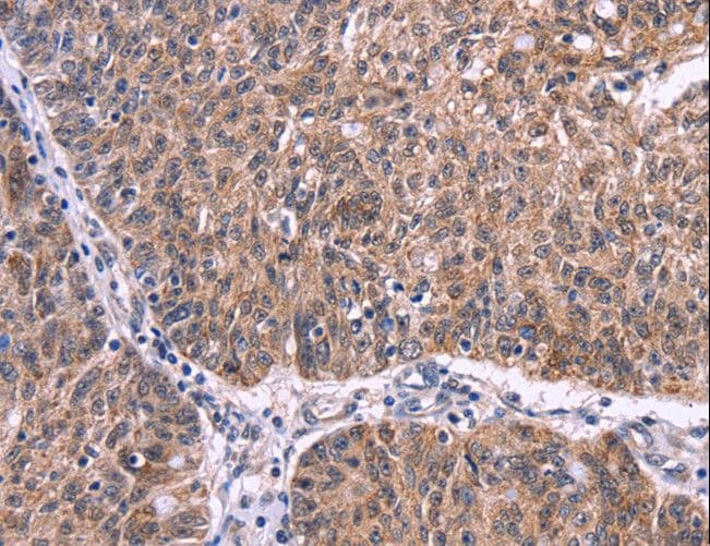EFNA5 / Ephrin A5 Antibody
