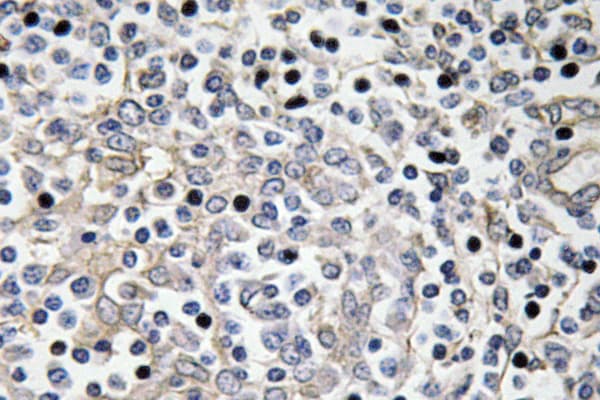 Polyclonal Rabbit anti-Human IL16 Antibody (aa48-97, IHC)