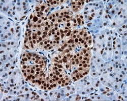 TLDC1 / KIAA1609 Antibody (clone OTI12B1)