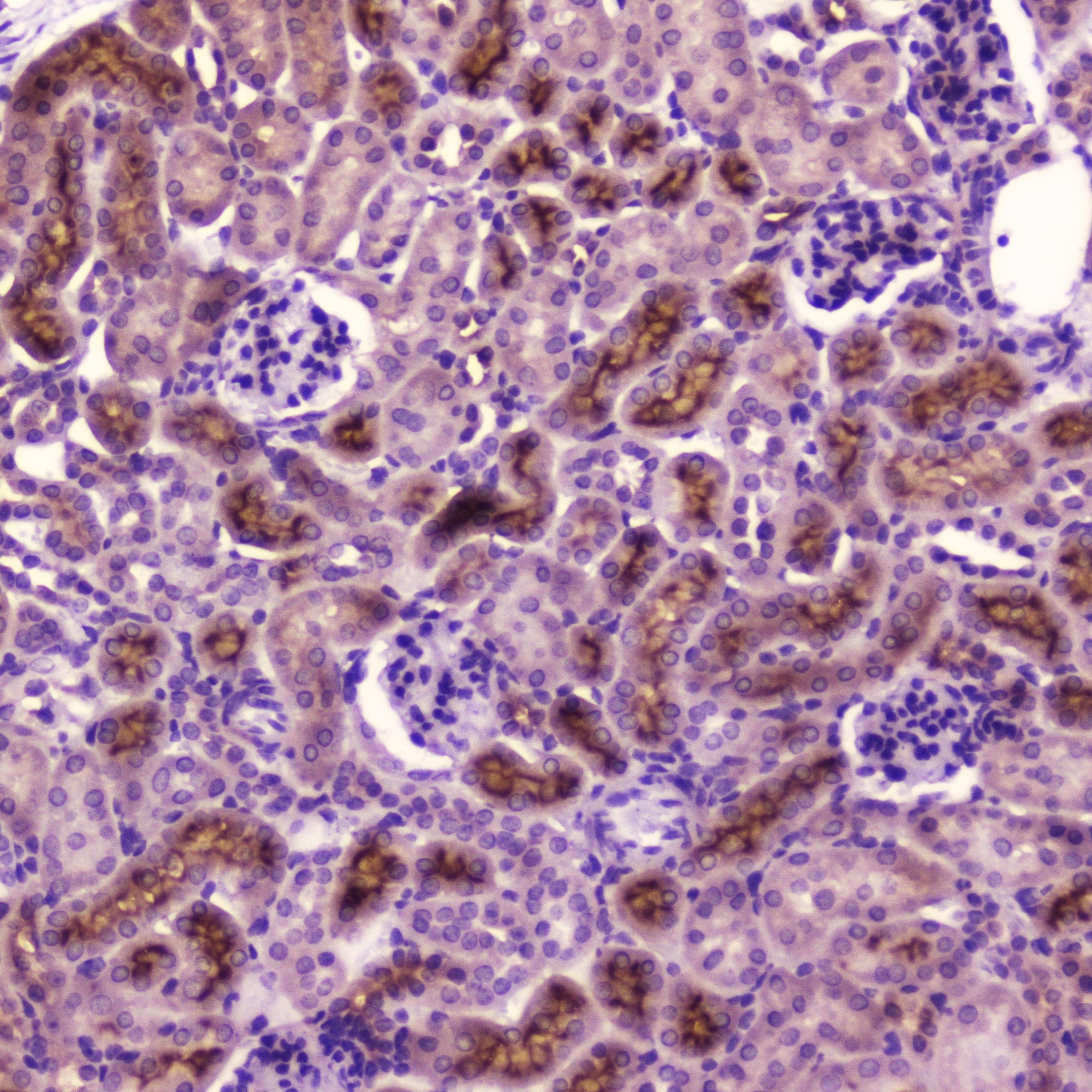 PDGFRB / PDGFR Beta Antibody