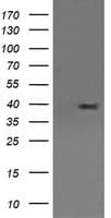 MAP2K3 / MEK3 / MKK3 Antibody (clone OTI5F9)