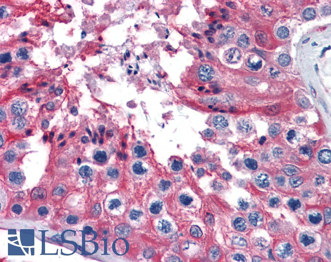 IHC-plus™ Monoclonal Mouse anti-Human TUBA4A / TUBA1 Antibody (clone 2E11, IHC, IF, WB)
