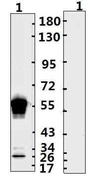 SARS-CoV-2 Nucleoprotein Antibody