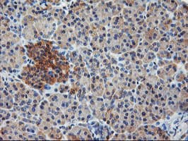 ILVBL Antibody (clone OTI8B12)