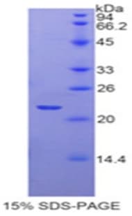 Rat VEGFA / VEGF Protein (Recombinant His)
