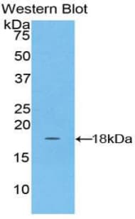 NDUFAB1 / ACP Antibody (aa5-129)