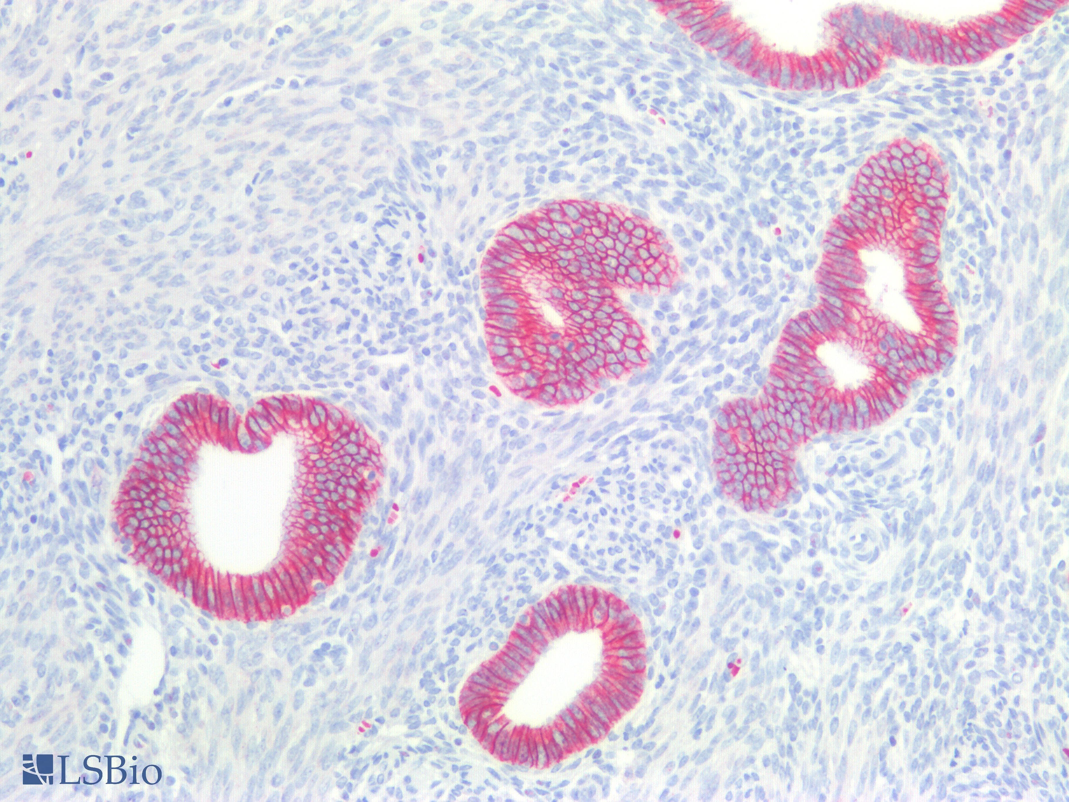 PathPlus™ CDH1 / E Cadherin Antibody (N-Terminus)