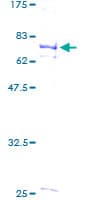 Human FLI1 Protein (Recombinant GST)