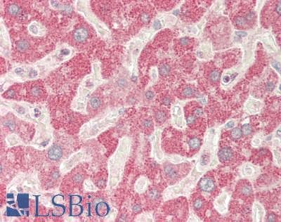 IHC-plus™ SERPINA6 / CBG Antibody