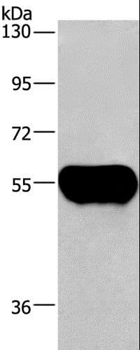 AHSG / Fetuin A Antibody
