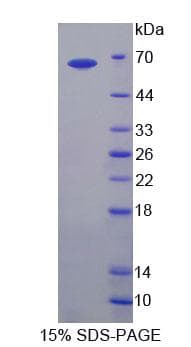 Human CABIN1 Protein (Recombinant His-GST, N-terminus)