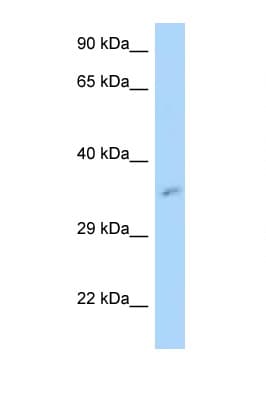 MRPL3 Antibody (aa32-81)