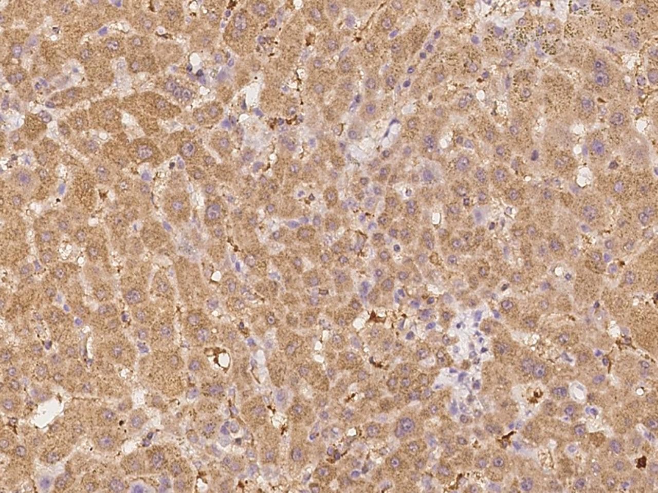 EGLN1 / PHD2 Antibody