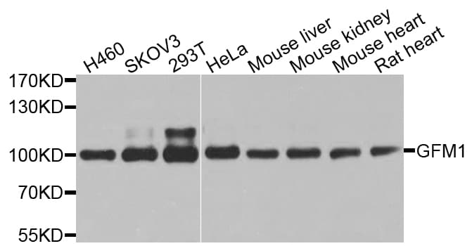 Polyclonal Rabbit anti-Human GFM1 Antibody (IHC, WB)