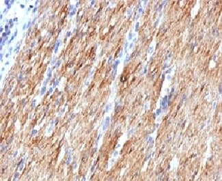 SMMHC / MYH11 Antibody (clone MYH11/923)
