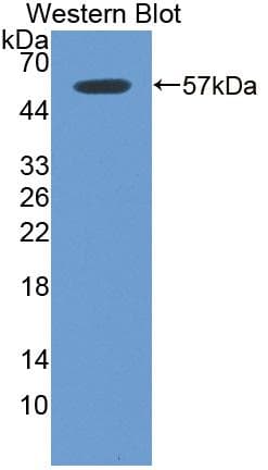 ITGB6 / Integrin Beta 6 Antibody (aa131-619, APC)