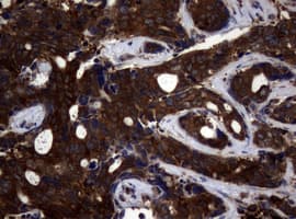 NME1 / NM23 Antibody (clone OTI24A2)