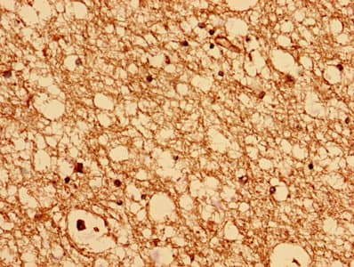 CHMP6 Antibody
