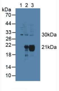 CYGB / Cytoglobin Antibody (aa1-190)