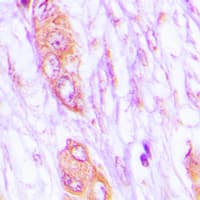 Polyclonal Rabbit anti-Human MELK Antibody (Internal, IHC, IF, WB)