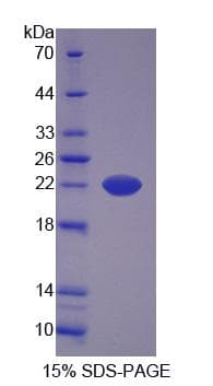 Dog APOM / Apolipoprotein M (Recombinant His-S)