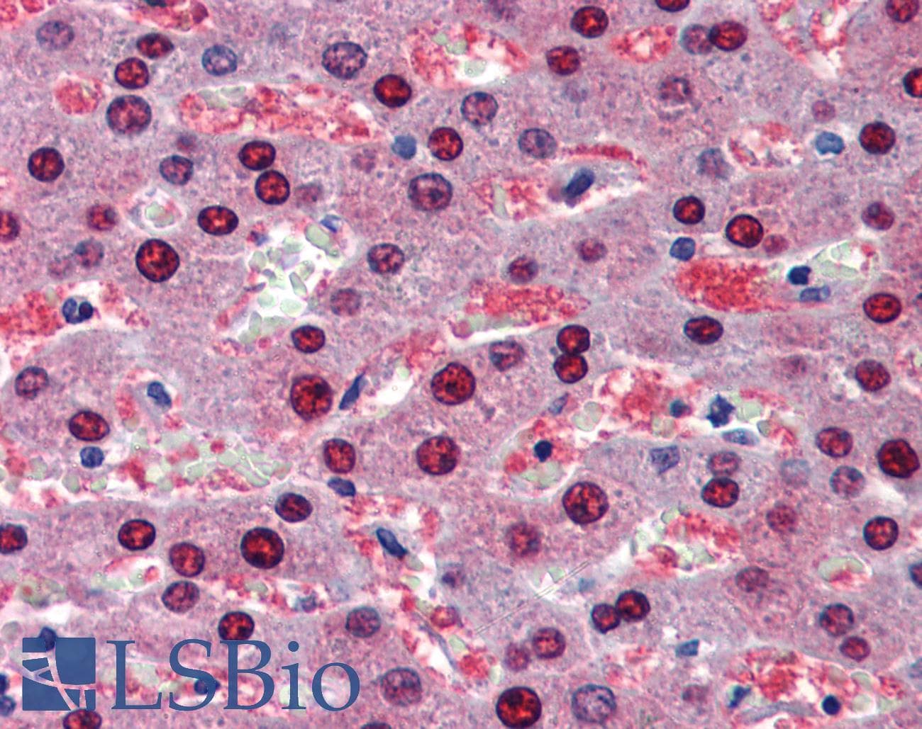 Polyclonal Rabbit anti-Human BMPER Antibody (aa501-550, IHC, WB)