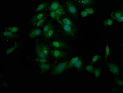 PHF9 / FANCL Antibody
