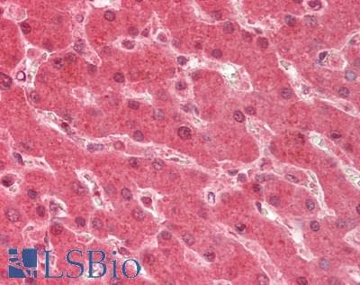 IHC-plus™ DAPK1 / DAP Kinase Antibody