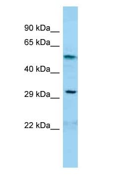 GDAP1 Antibody (aa152-201)