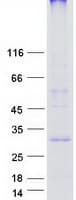 Human KRTCAP3 Protein (Recombinant Myc-DDK (Flag))