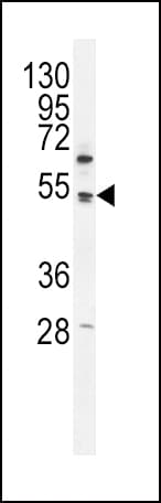 IHC-plus™ PDK4 Antibody (aa382-410)