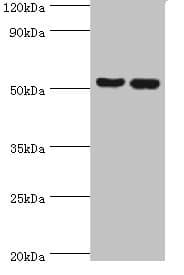 Polyclonal Rabbit anti-Human FKBP4 / FKBP52 Antibody (aa220-459, IHC, WB)