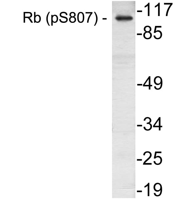 Polyclonal Rabbit anti-Human RB1 / Retinoblastoma / RB Antibody (phospho-Ser807, IHC, WB)