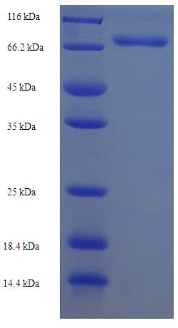 Human DPH2 Protein (Recombinant His-SUMO)