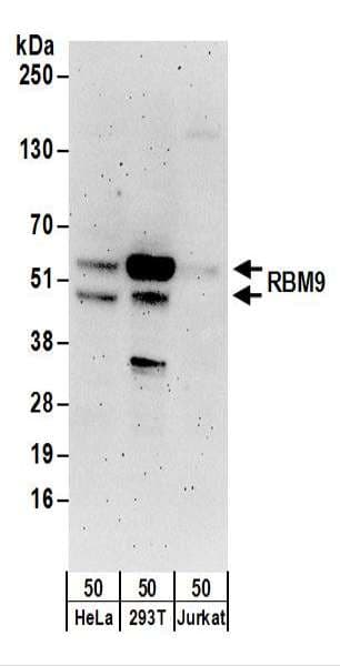 RBFOX2 / RBM9 Antibody (aa1-50)