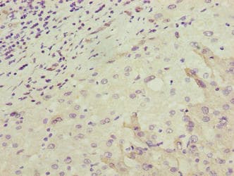 OR2H1 Antibody