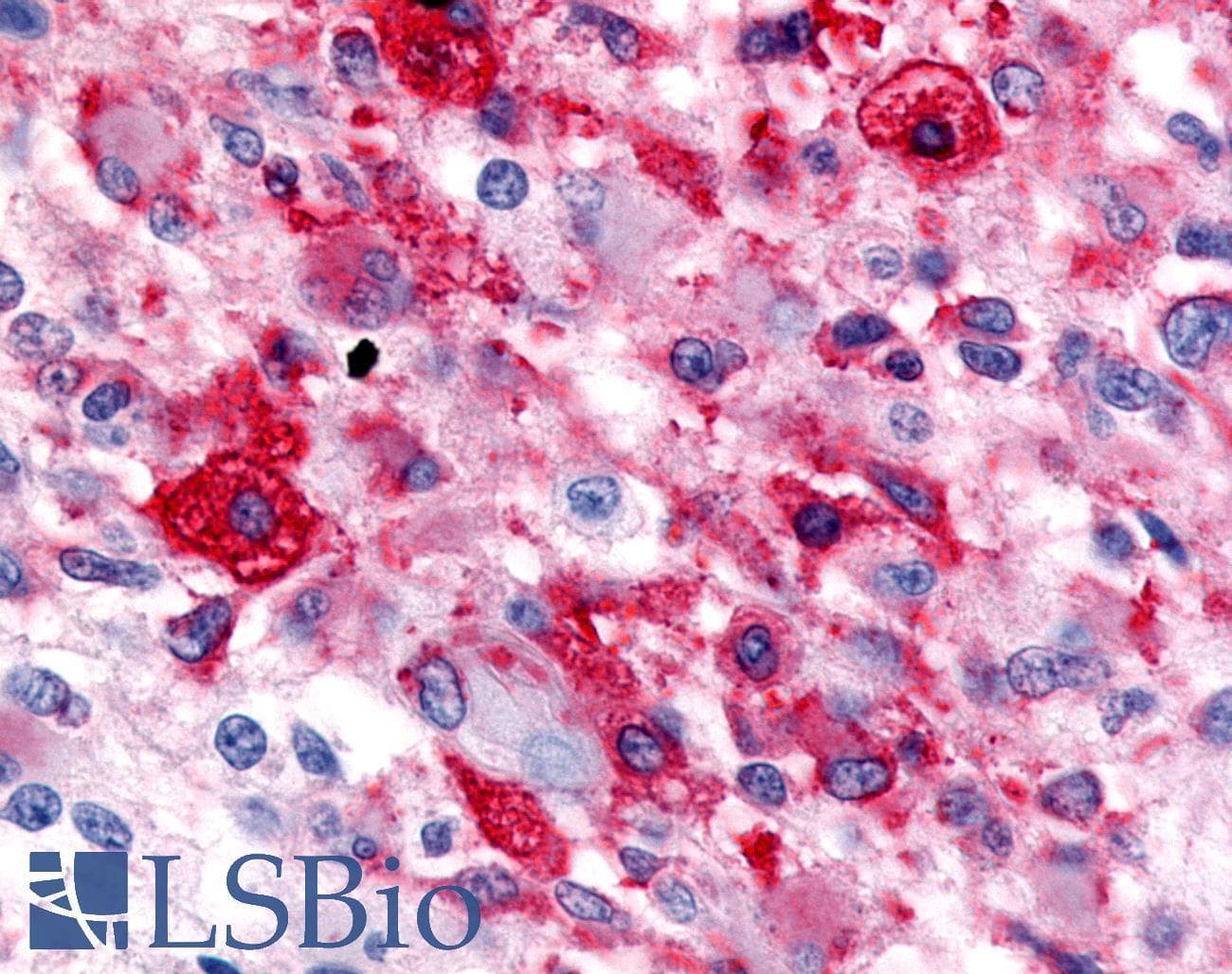 PathPlus™ HNF4G / HNF4 Gamma Antibody (Internal)