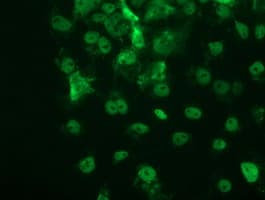 Monoclonal Mouse anti-Human TP53 / p53 Antibody (clone OTI3G9, IHC, IF, WB)