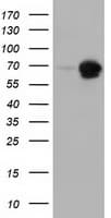 Monoclonal Mouse anti-Human AK5 / Adenylate Kinase 5 Antibody (clone OTI1D6, IF, WB)