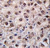 PEMT Antibody (aa1-30)