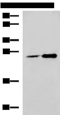 Polyclonal Rabbit anti-Human DGCR6L Antibody (IHC, WB)