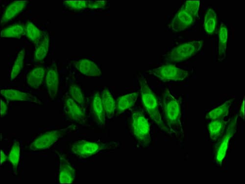 Polyclonal Rabbit anti-Human FOXC1 Antibody (IF, WB)