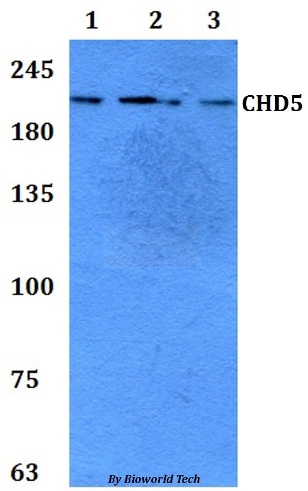 Polyclonal Rabbit anti-Human CHD5 Antibody (WB)