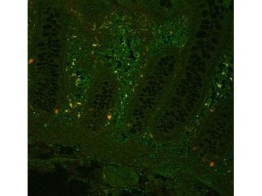 TNF Alpha Antibody