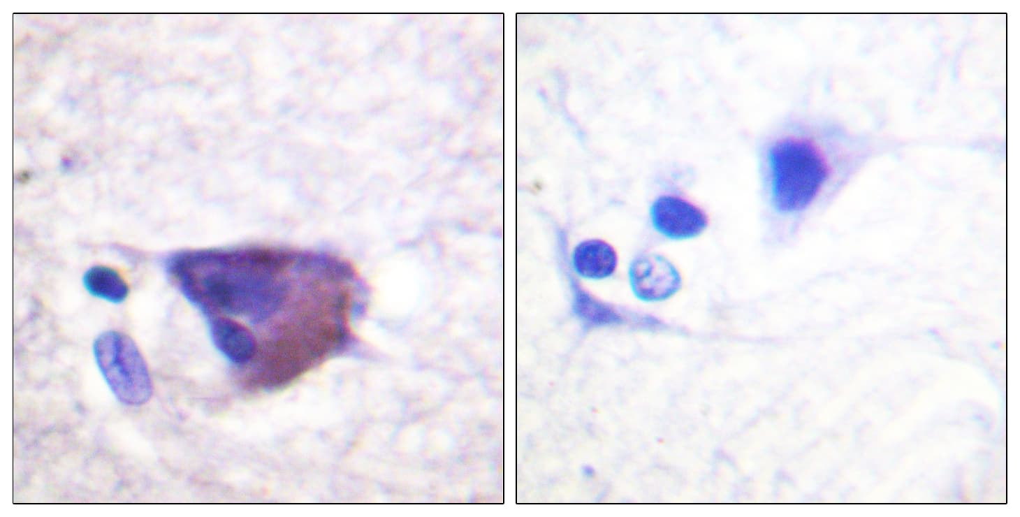 KCNB1 / Kv2.1 Antibody (phospho-Ser567)