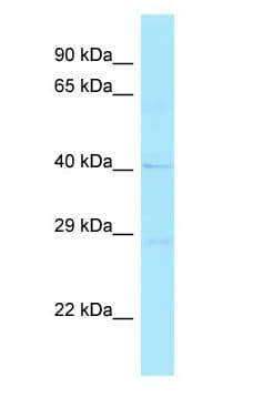 Polyclonal Rabbit anti-Human RND2 Antibody (C-Terminus, WB)