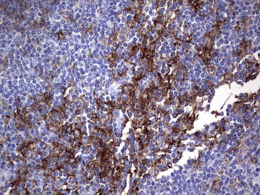 MSLN / Mesothelin Antibody (aa270-493, clone OTI1G8, Carrier-free)