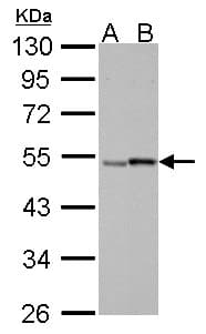 IHC-plus™ Polyclonal Rabbit anti-Human RARG / RAR-Gamma Antibody (IHC, WB)
